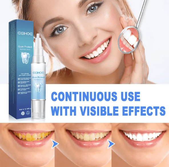 Teeth Repair Gel - Lifestyle Haven