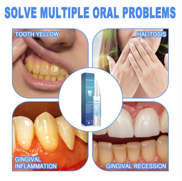 Teeth Repair Gel - Lifestyle Haven