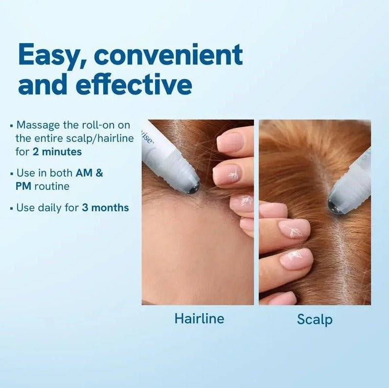 Hair Ball Essence Rosemary Growth Oil - Lifestyle Haven