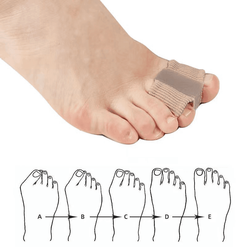 Fiber Toe Separator - Lifestyle Haven