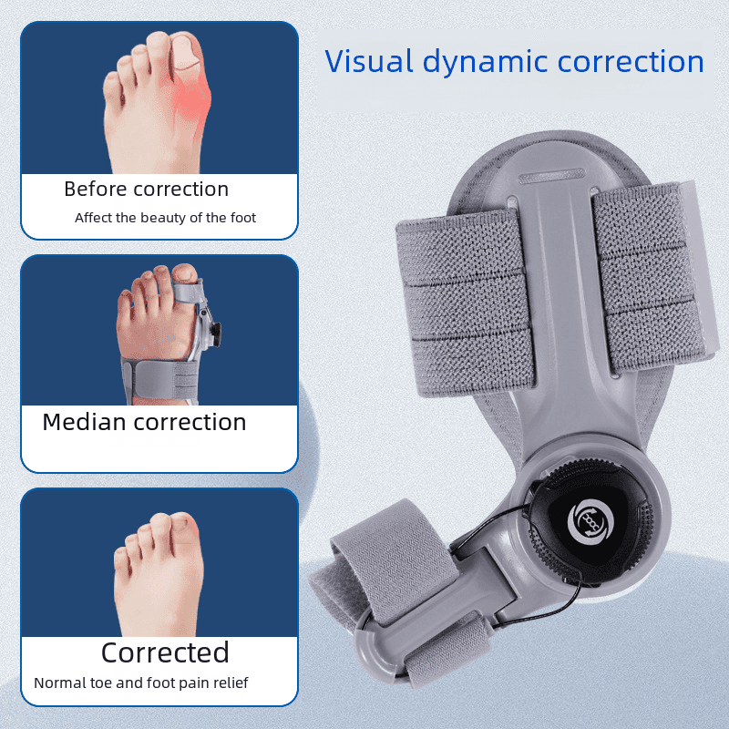 Upgraded Adjustable Bunion Corrector - Lifestyle Haven