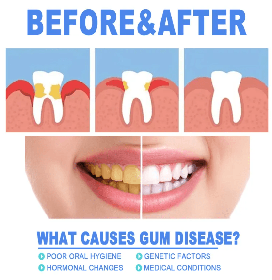 Teeth Repair Gel - Lifestyle Haven