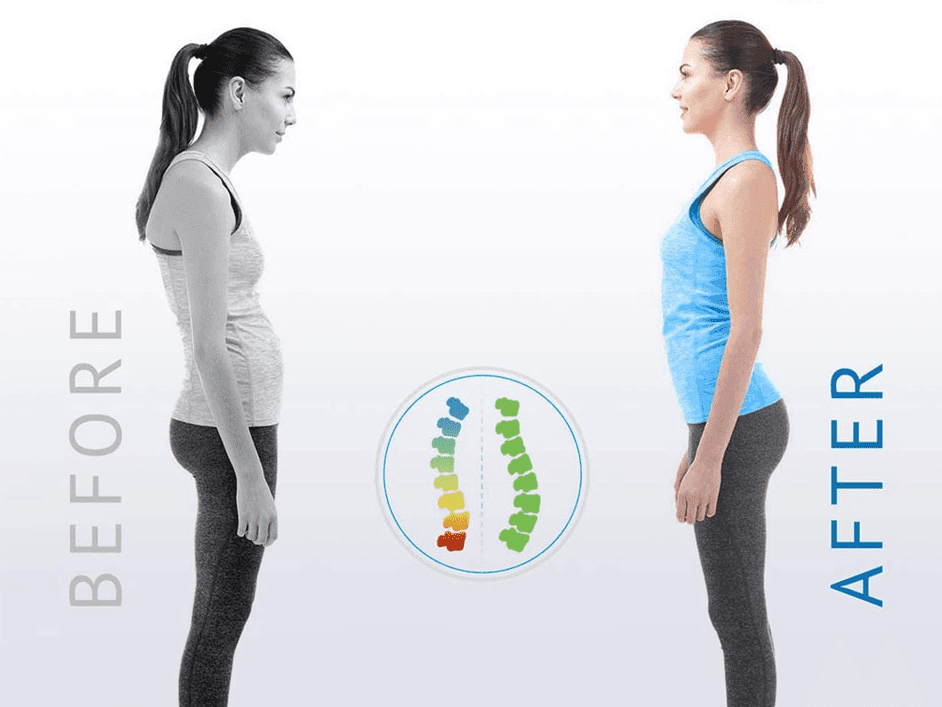 Posture Corrector - Lifestyle Haven