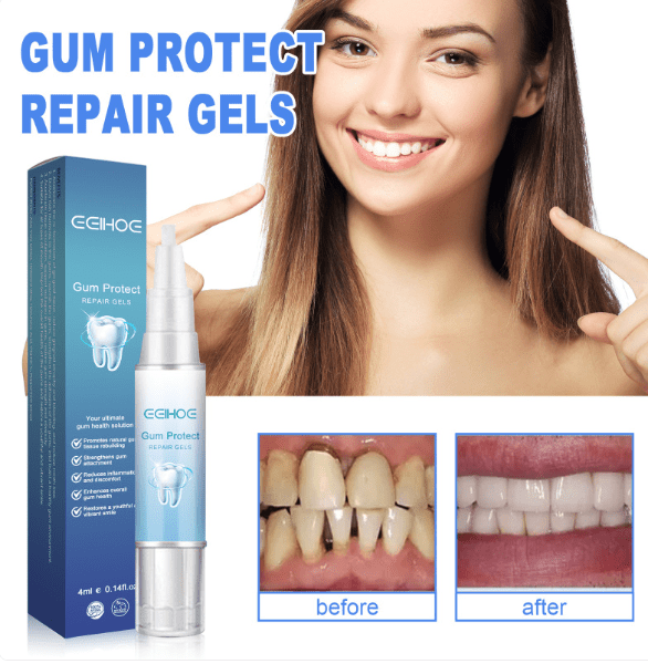 Teeth Repair Gel - Lifestyle Haven